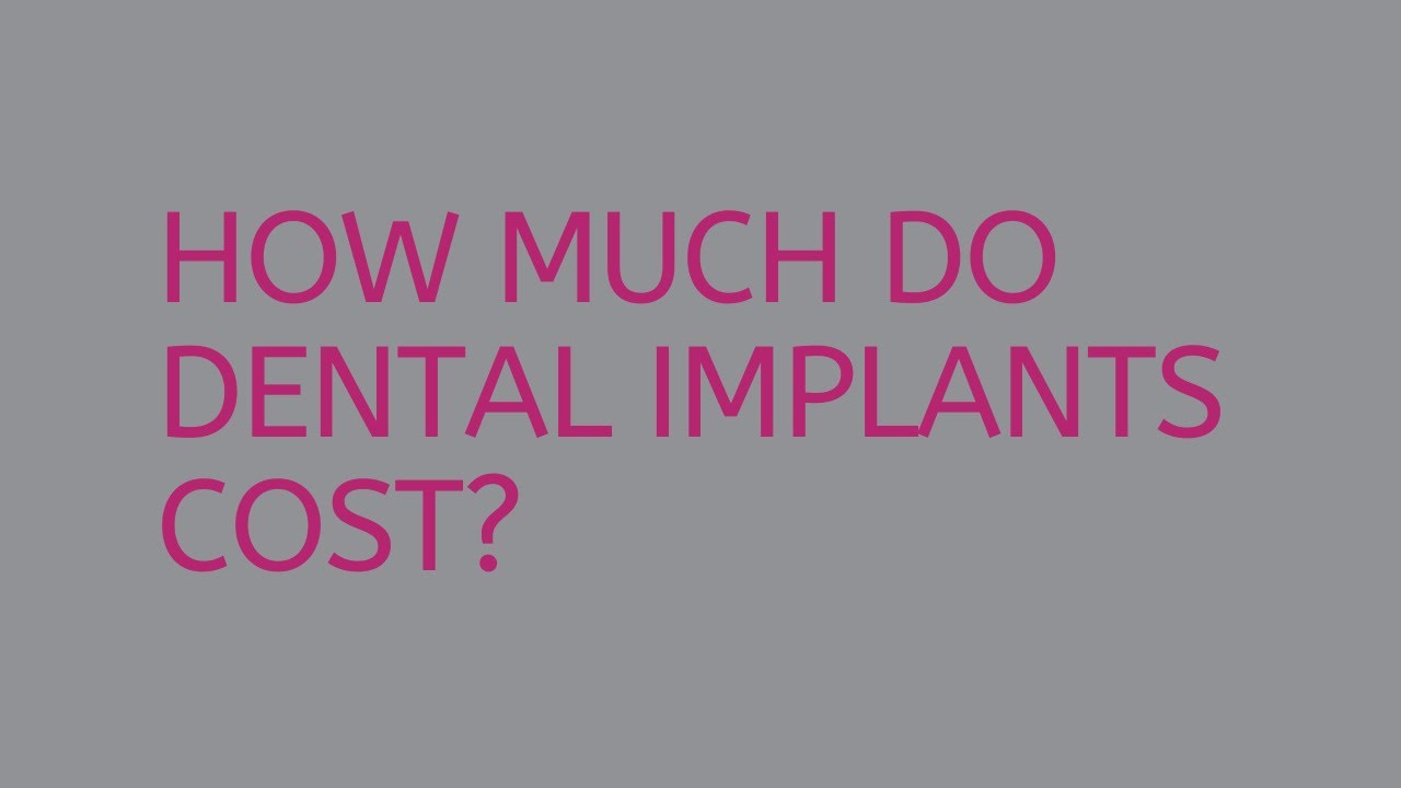 ≫ How Much Does Dental Implants Cost In Johannesburg The Dizaldo Blog!